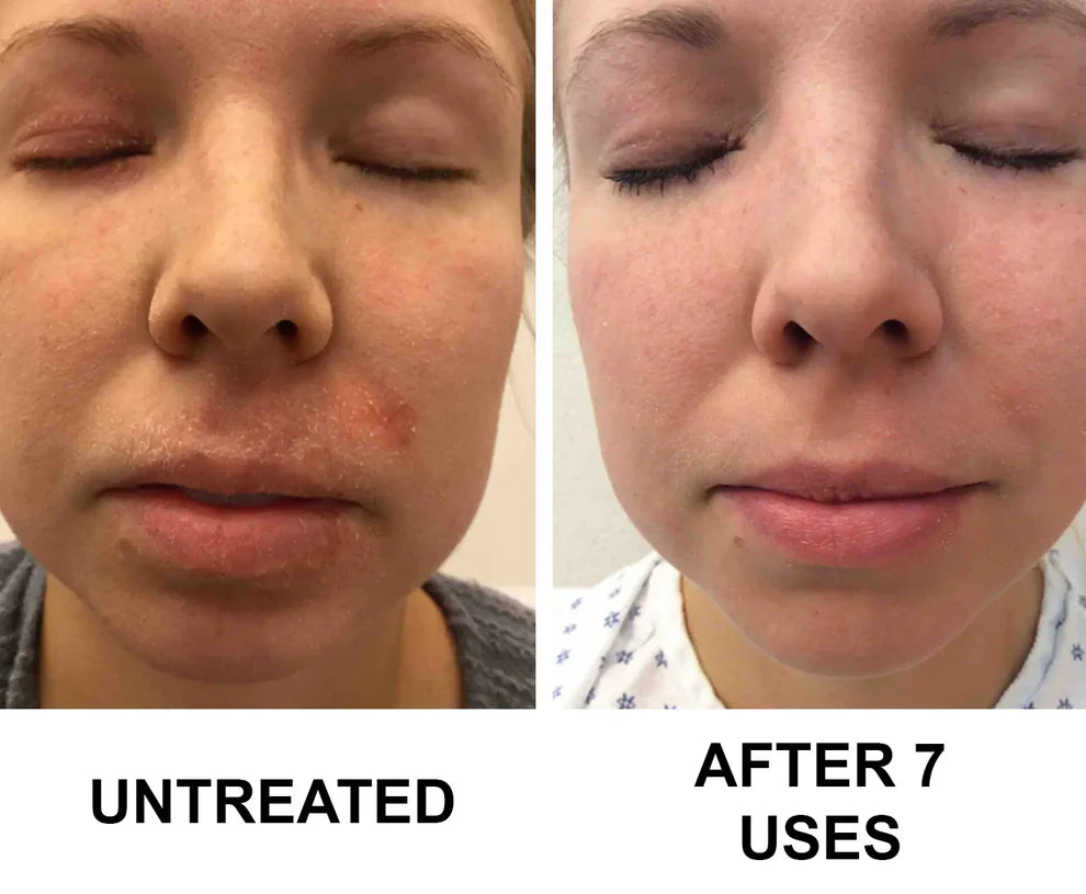 Complete Renewal & Relief Serum