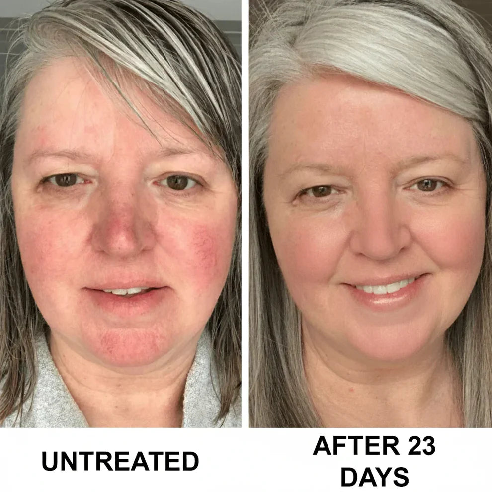 Complete Renewal & Relief Serum