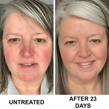 Complete Renewal & Relief Serum