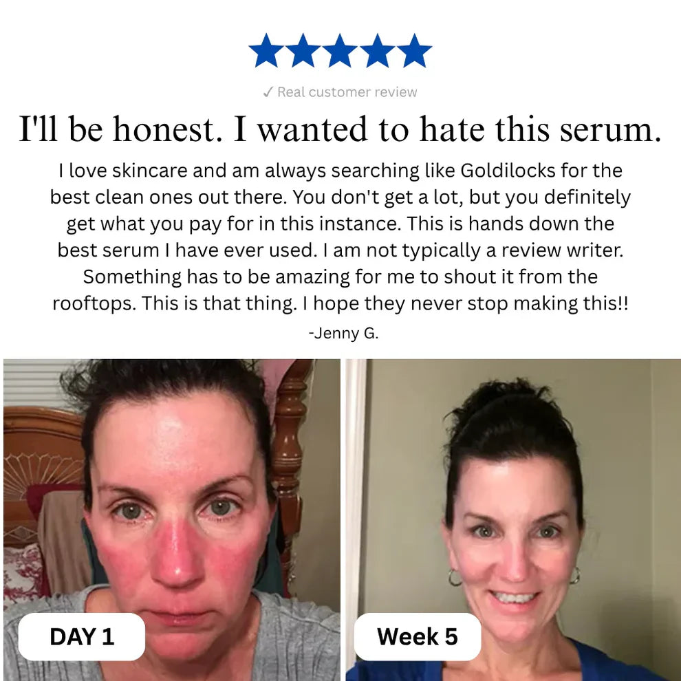 Complete Renewal & Relief Serum