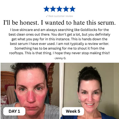 Complete Renewal & Relief Serum