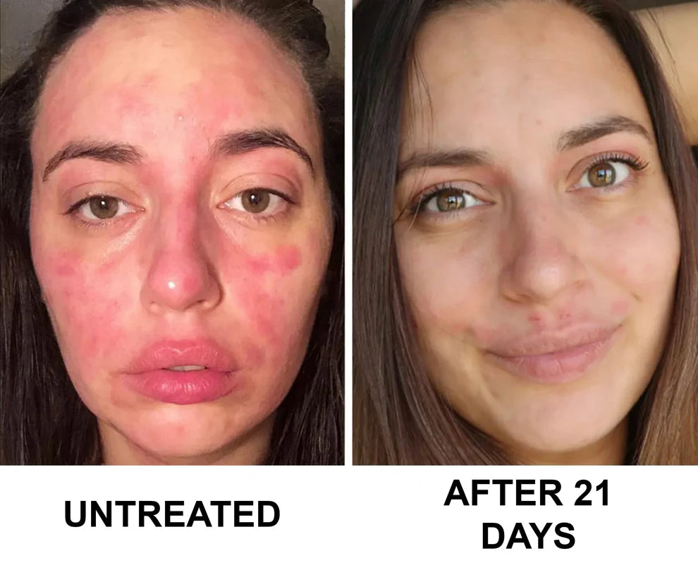 Complete Renewal & Relief Serum