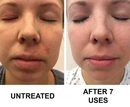 Complete Renewal & Relief Serum